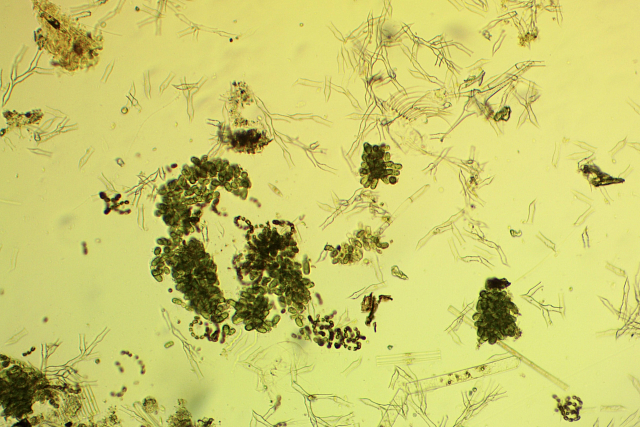 Биоразнообразие и экологические свойства золотистых водорослей планктона озера Тургояк и дериватов в связи с качеством воды